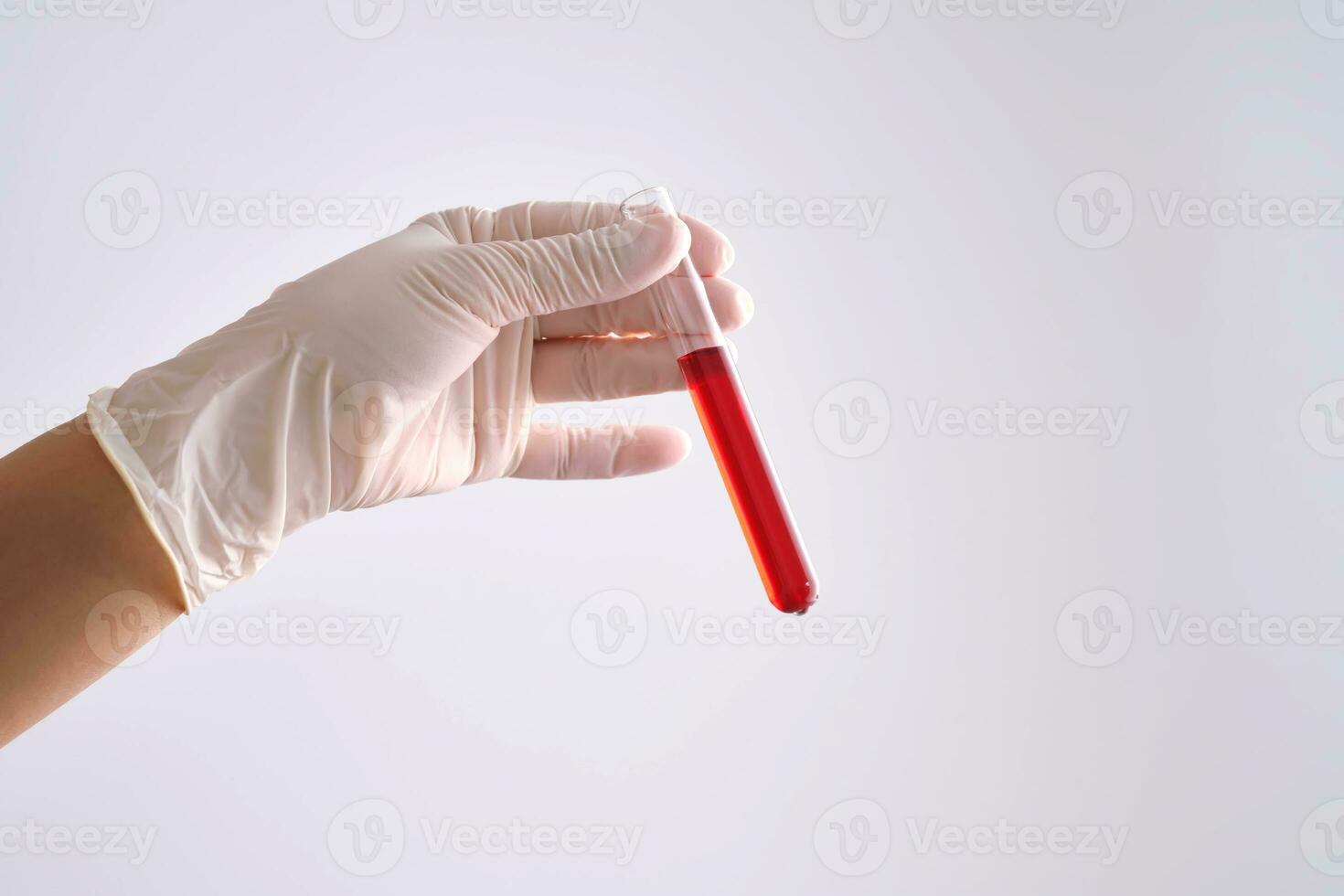 Test tube with blood in the hand. photo