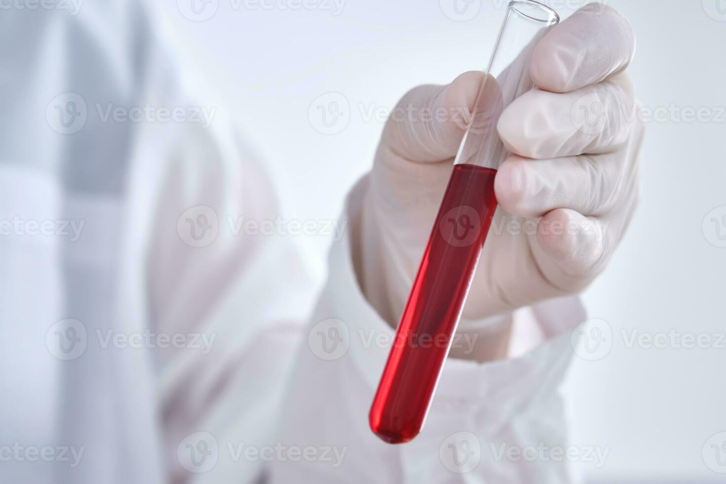 Test tube with blood in the hand. photo