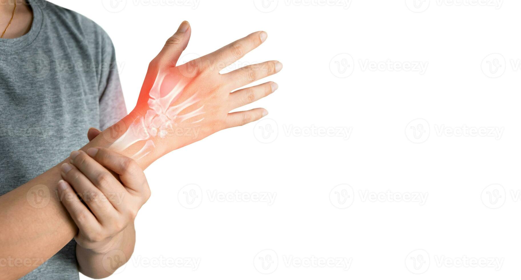 Inflammation of the muscles and bones of the arm photo