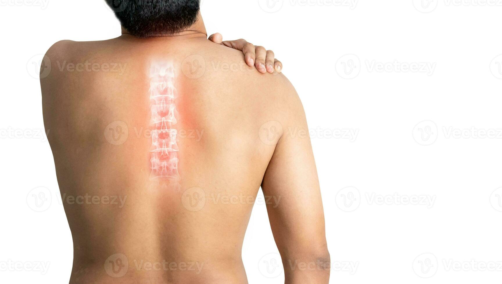 inflamed human spine pain of white background photo