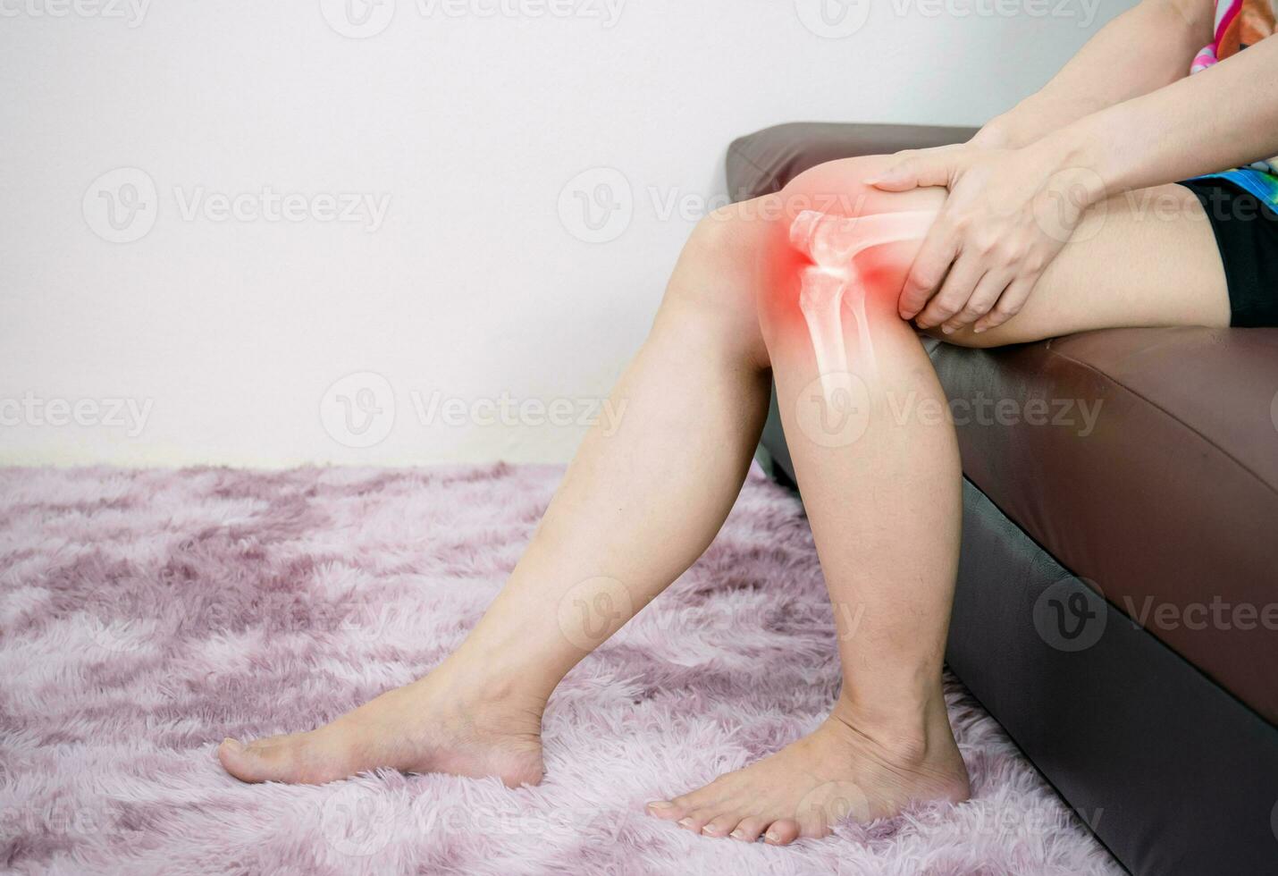 Human leg osteoarthritis inflammation of bone joints photo