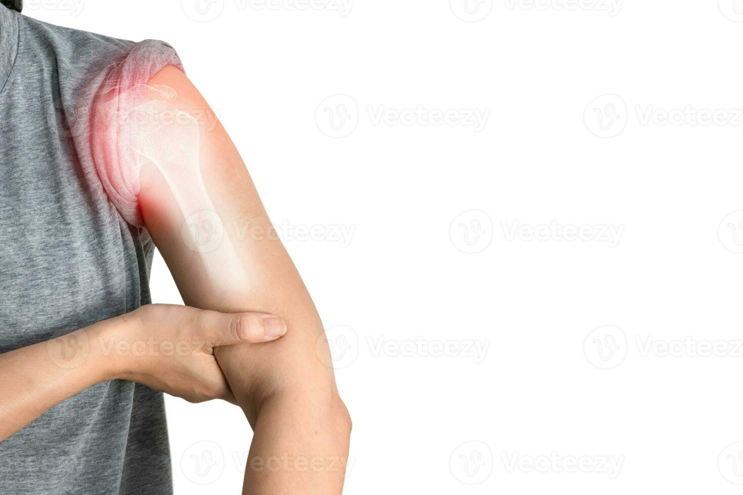 Inflammation of the muscles and bones of the arm photo