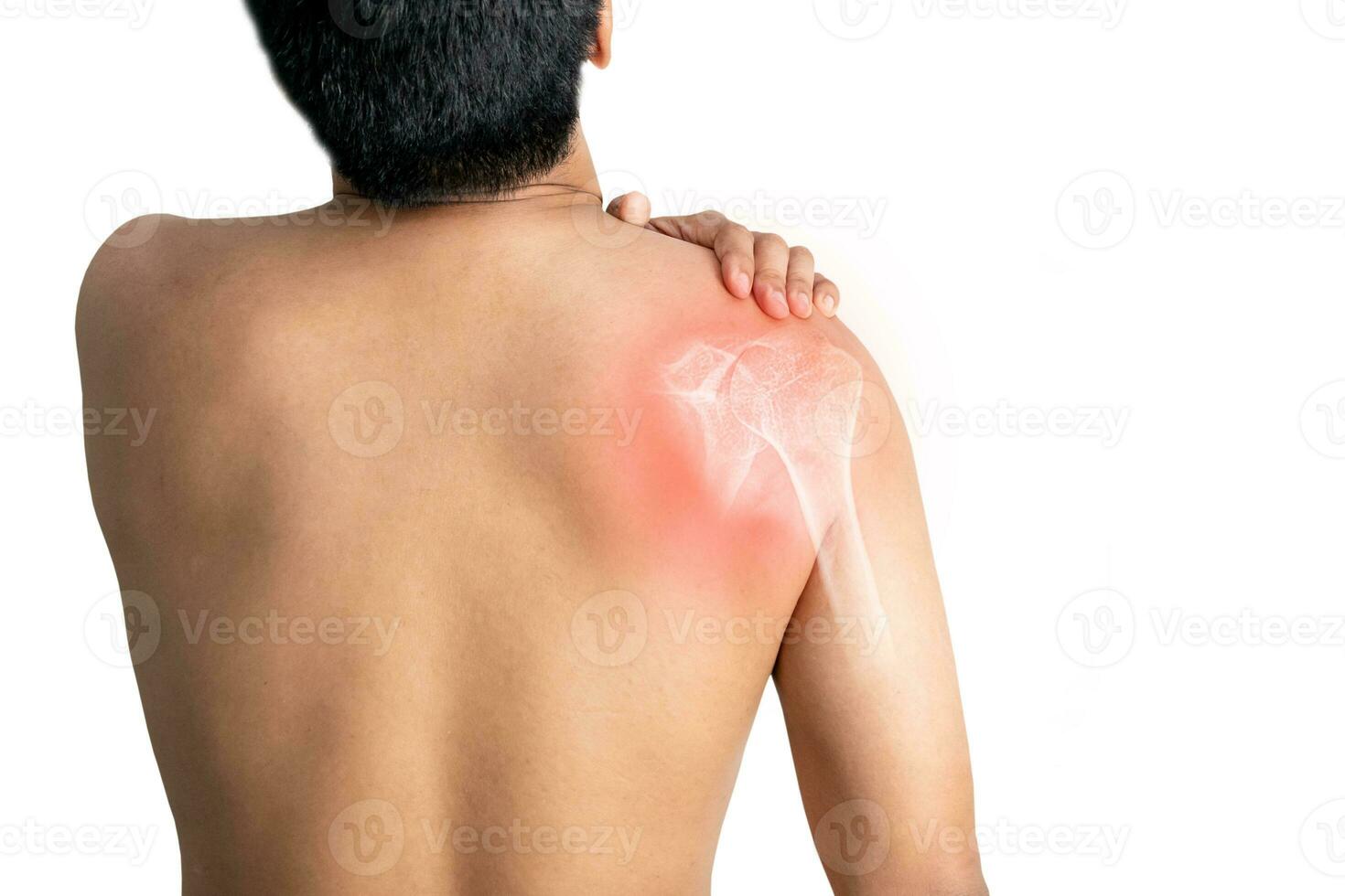 Inflammation of the muscles and bones of the arm photo