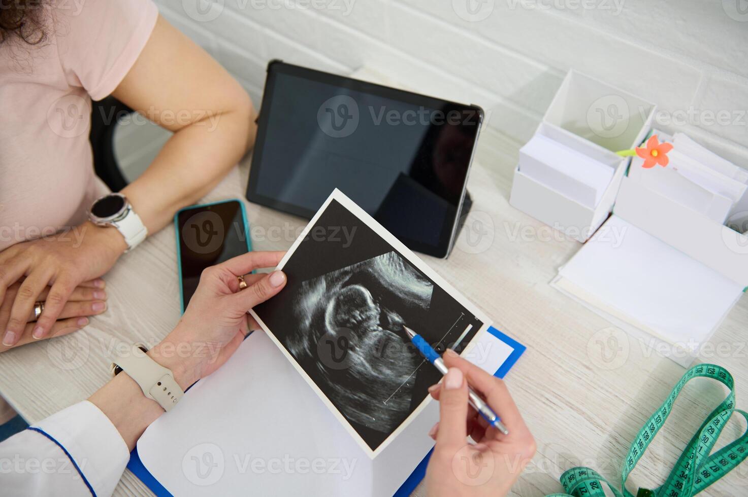 Top view hands of gynecologist doctor explaining to pregnant woman the development of child in womb on ultrasound scan photo