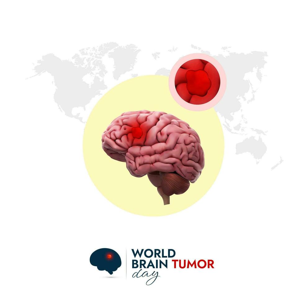 mundo cerebro tumor día diseño para untado conciencia y educar personas acerca de cerebro tumores vector