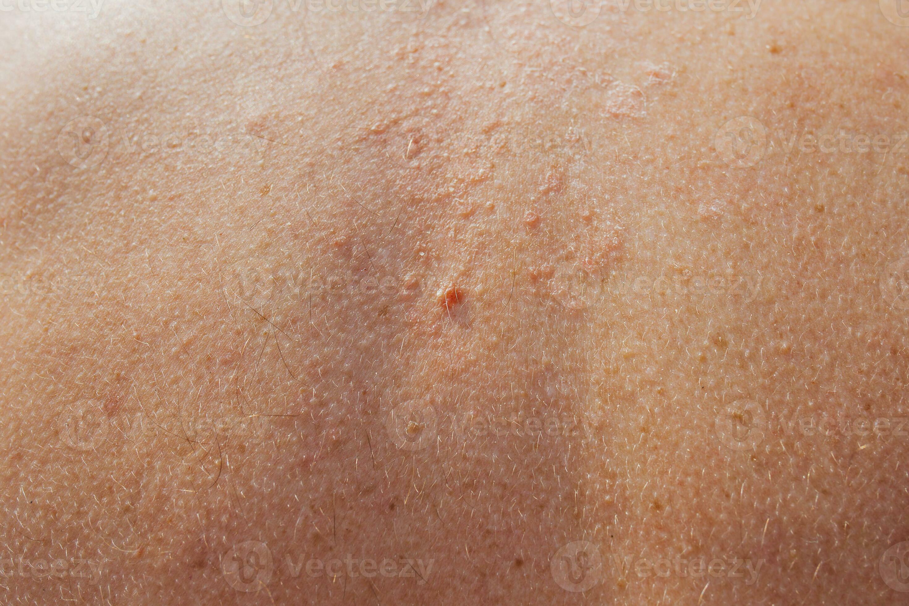 Dry Skin Condition lethargic-and-dragging-feet-greenpet