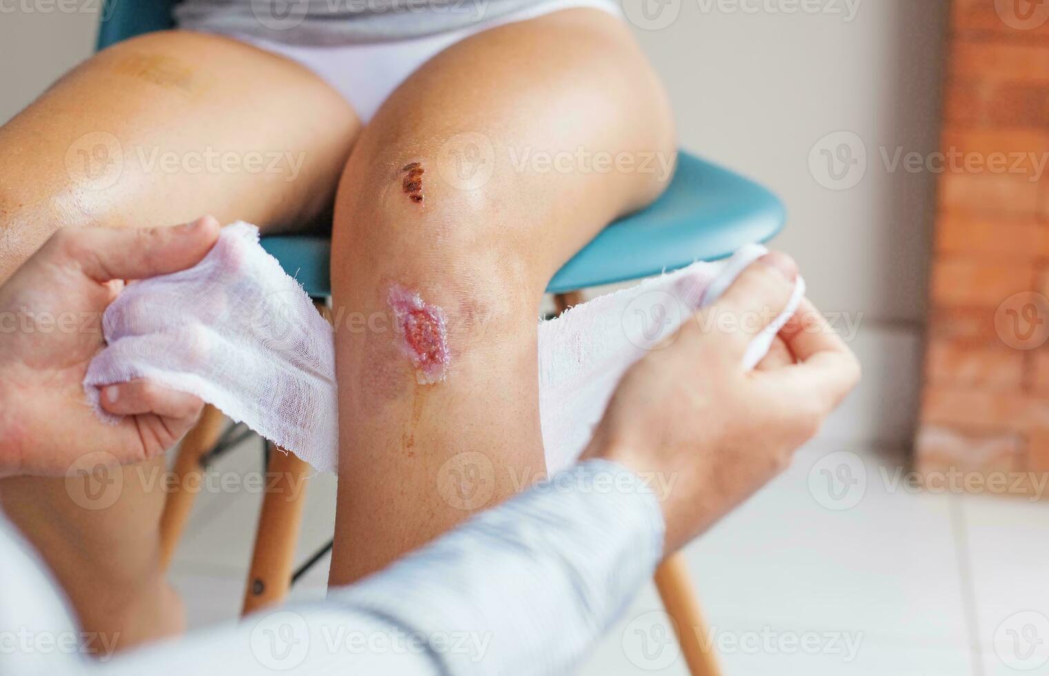 wound cleansing process in clinic photo
