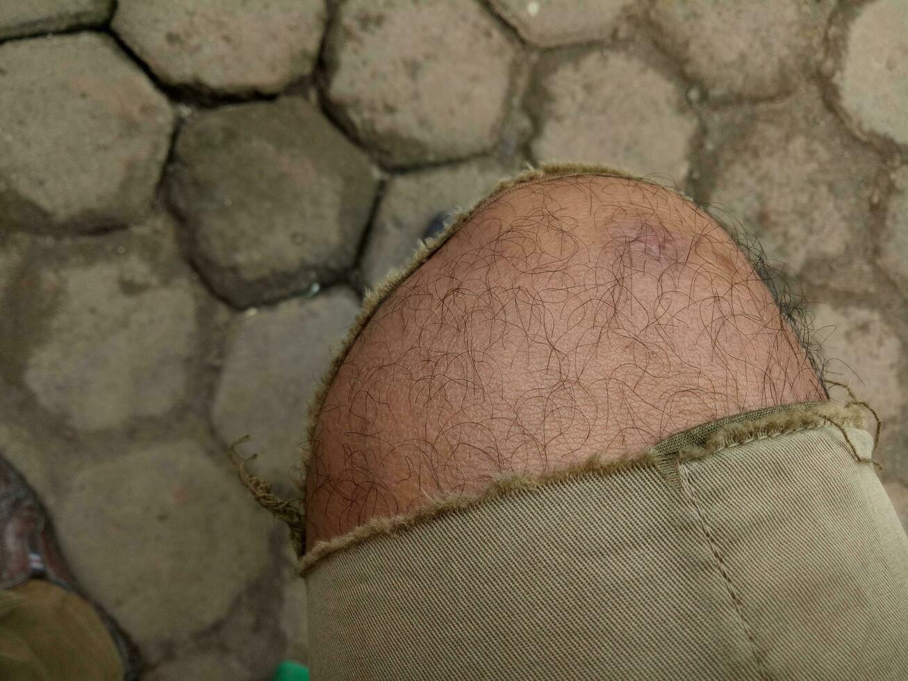 Photo of a boy's leg wearing torn brown trousers against a hexagonal brick floor in the background