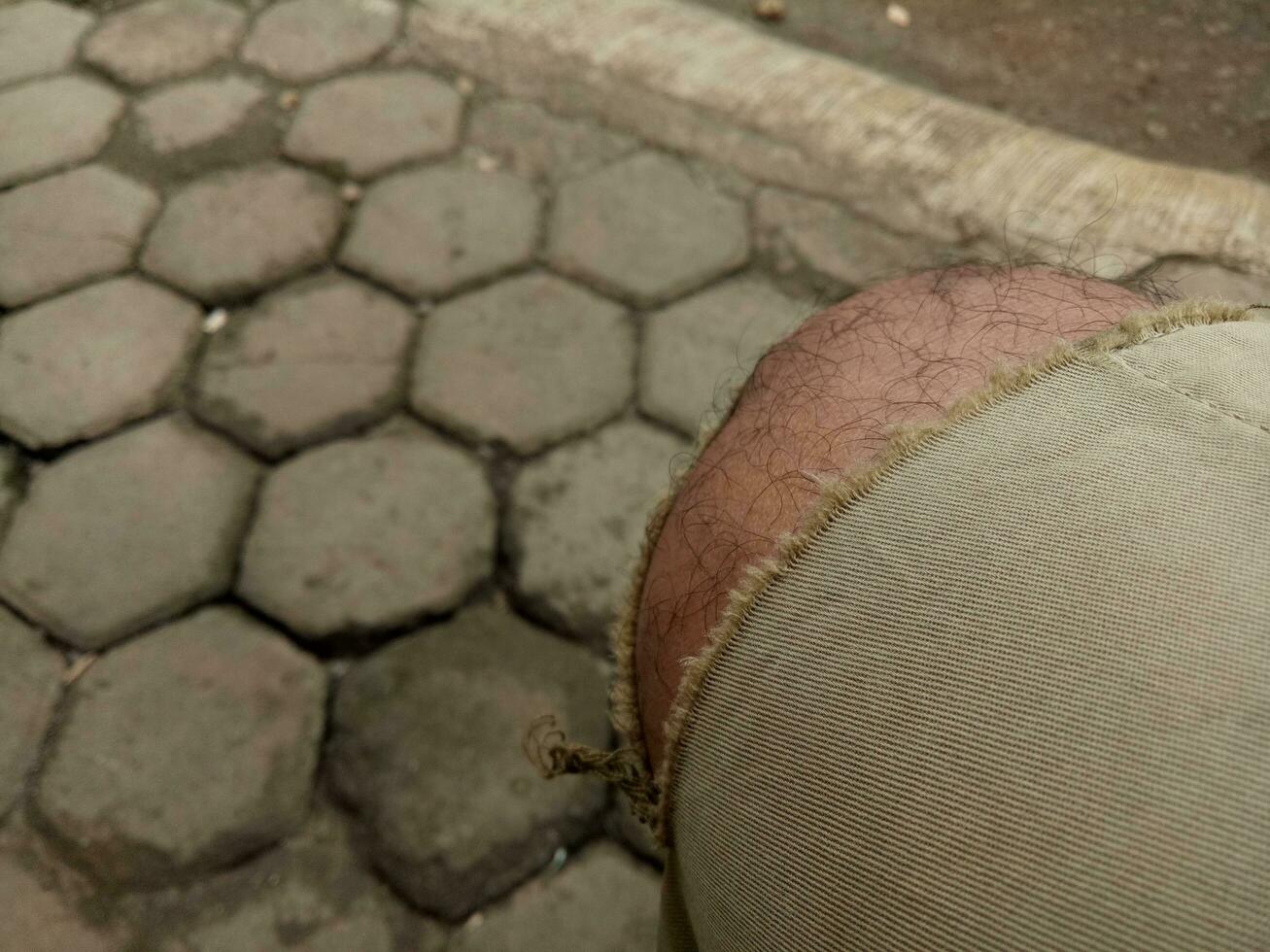 Photo of a boy's leg wearing torn brown trousers against a hexagonal brick floor in the background