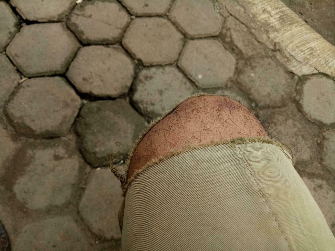 Photo of a boy's leg wearing torn brown trousers against a hexagonal brick floor in the background