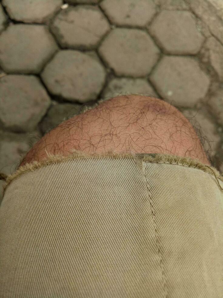 Photo of a boy's leg wearing torn brown trousers against a hexagonal brick floor in the background