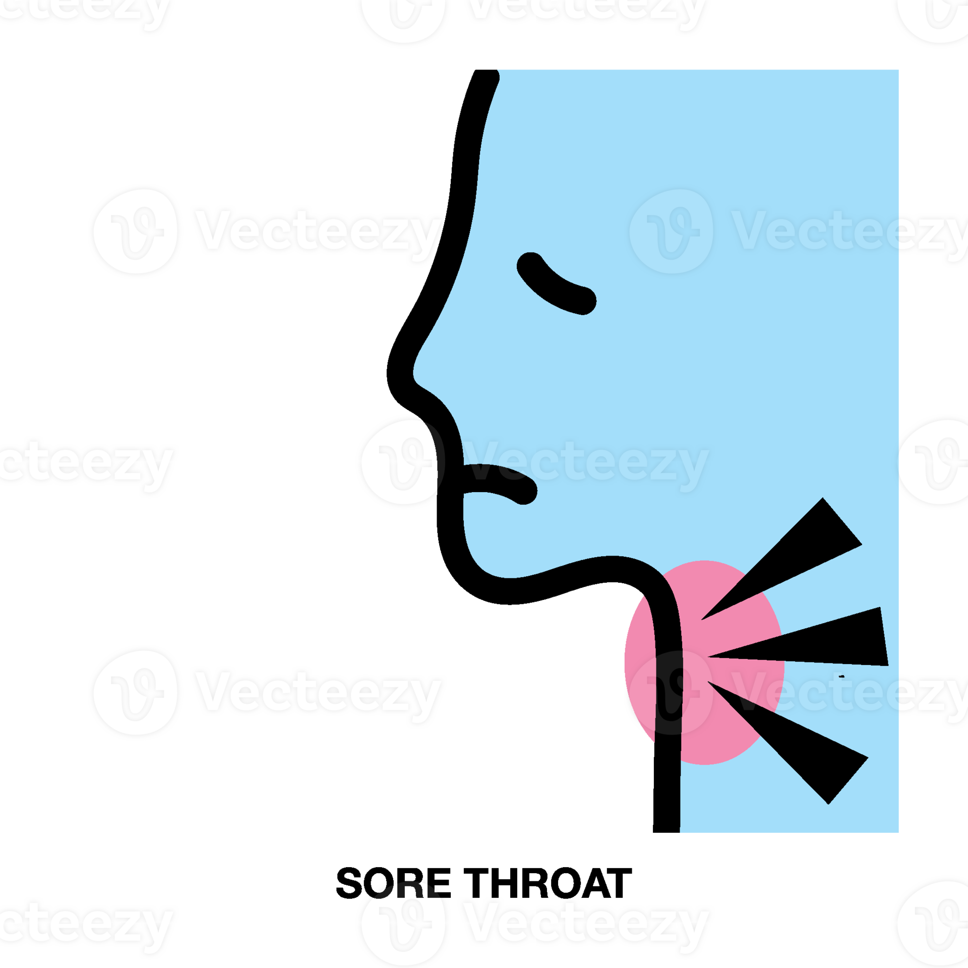 Allergic Reaction, Itchy skin , Skin rash, Joint pain, Body pain