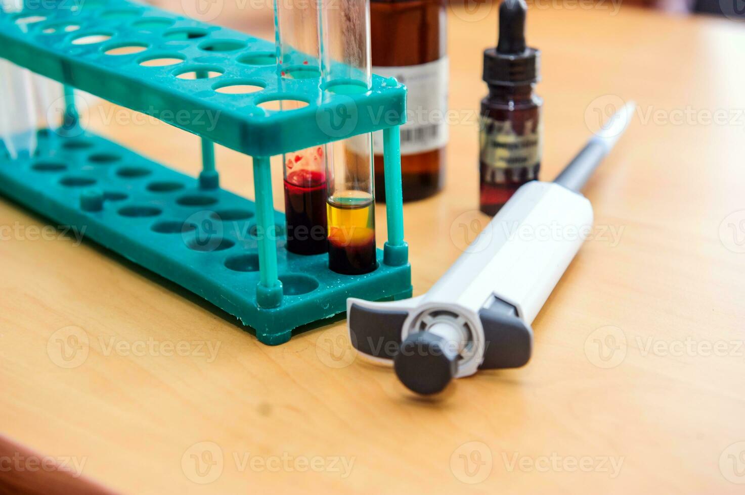 Hands with test tubes close-up. Hands in medical gloves hold tubes. Concept blood test for the presence of a virus. Viral disease test. Human blood in the laboratory. Virusology. photo