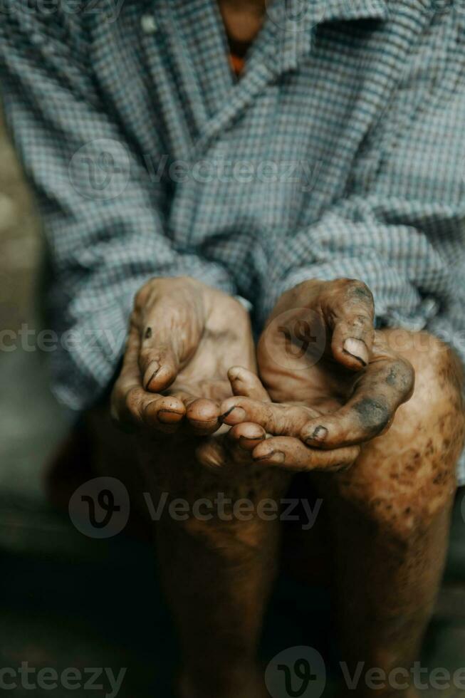 Close up of male wrinkled hands, old man is wearing  skin disease and anxiety Copy space. photo