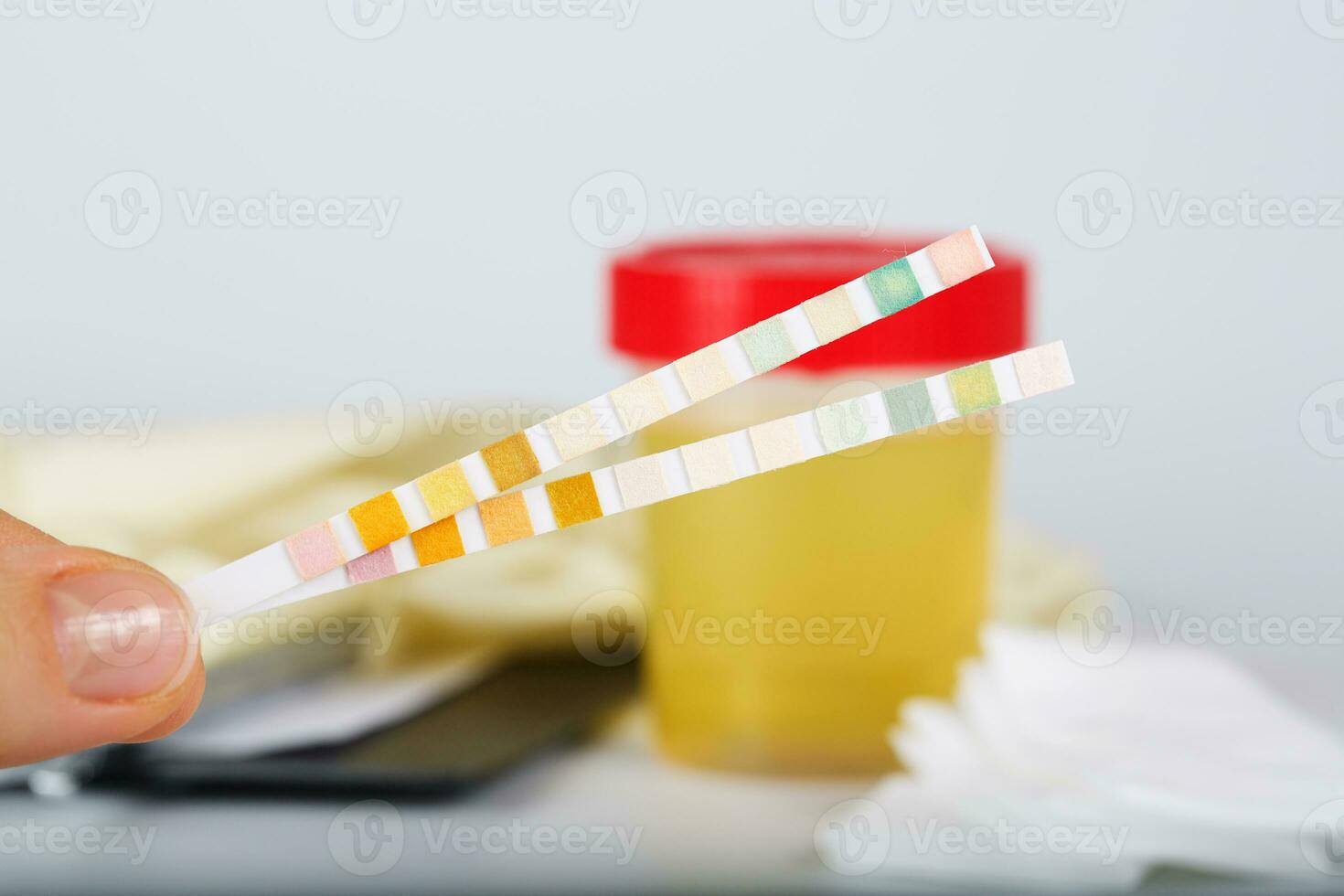 Collection cup with urine test on a table of a lab technician. photo