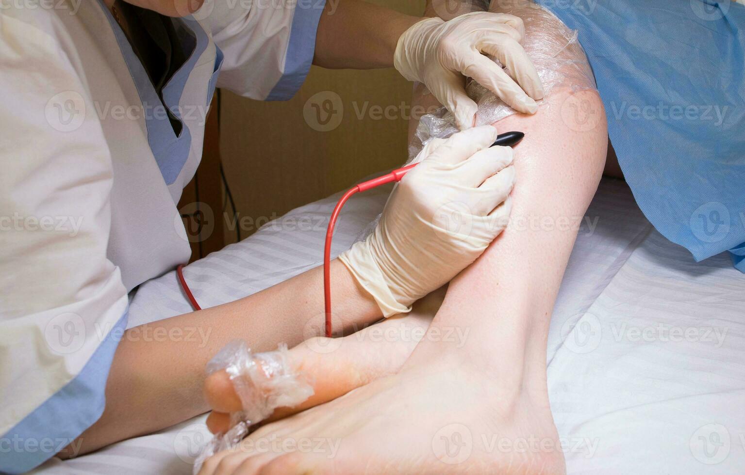 Cosmetologist does needle epilation to her patient. photo