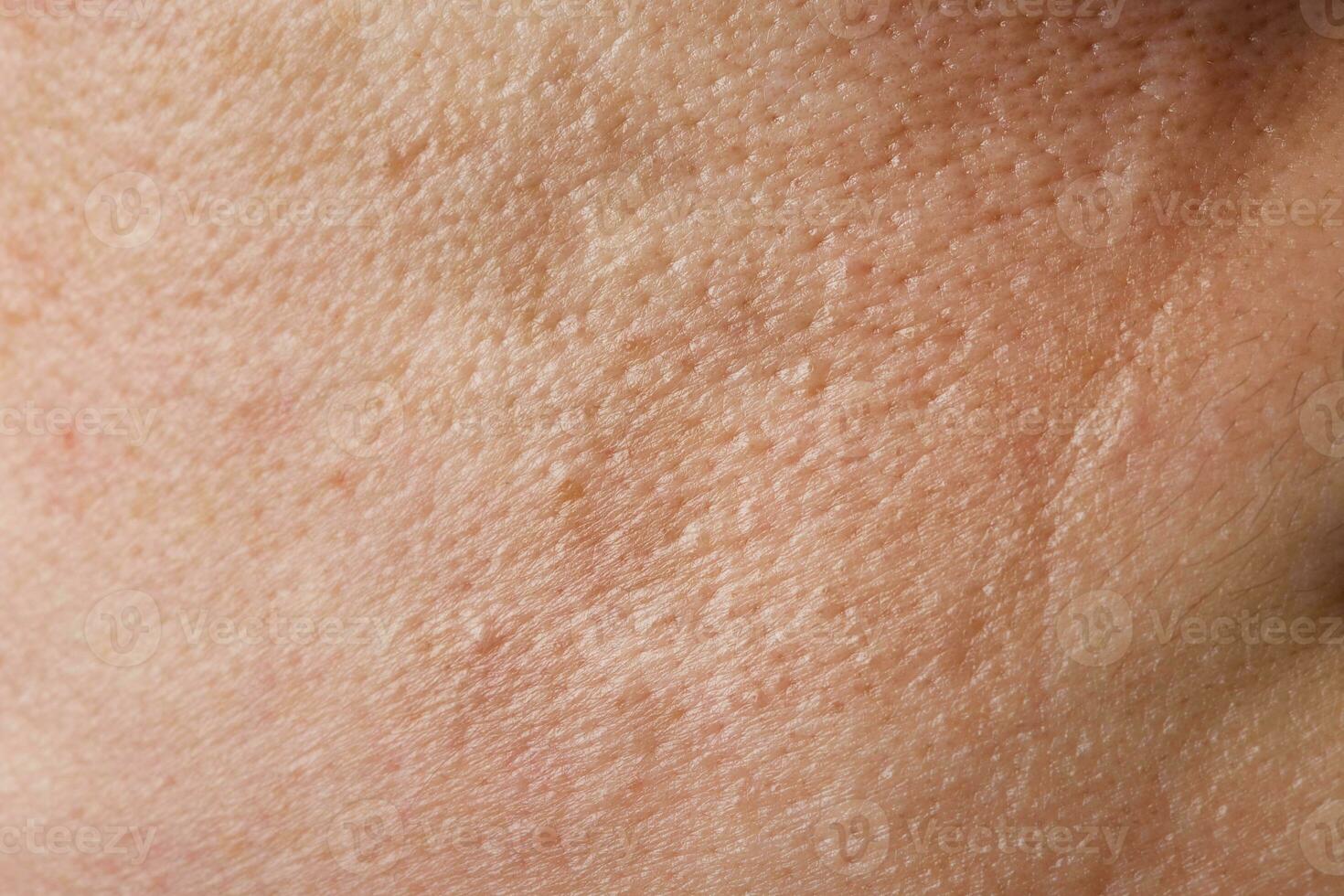 Face skin of young lady between 30 and 35 years old. Closeup photo