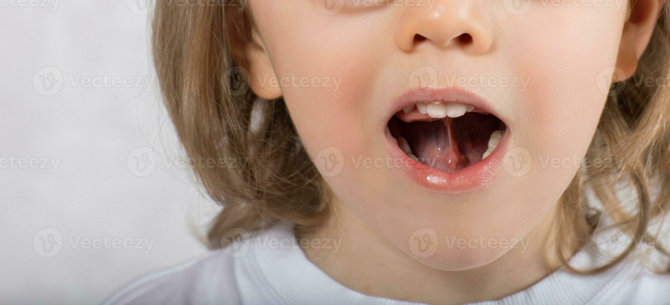 Boy of five years is making some tongue exercises. photo