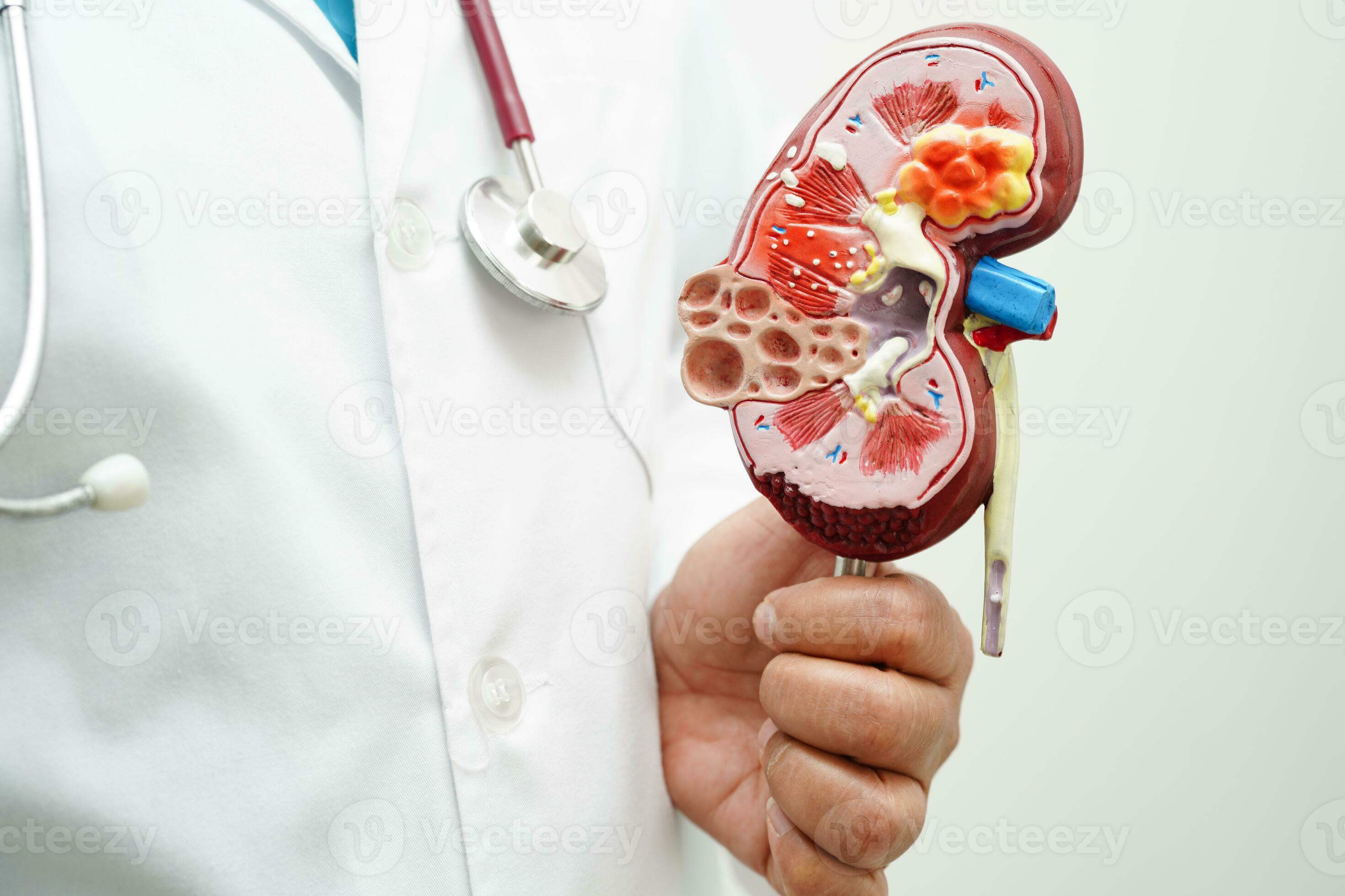 Chronic kidney disease, doctor holding model for treatment urinary
