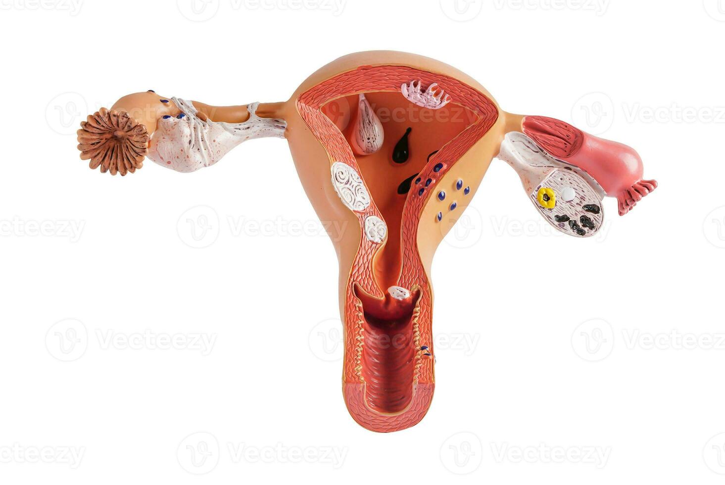 Uterus model isolated on white background with clipping path, doctor holding anatomy model for study diagnosis and treatment in hospital. photo