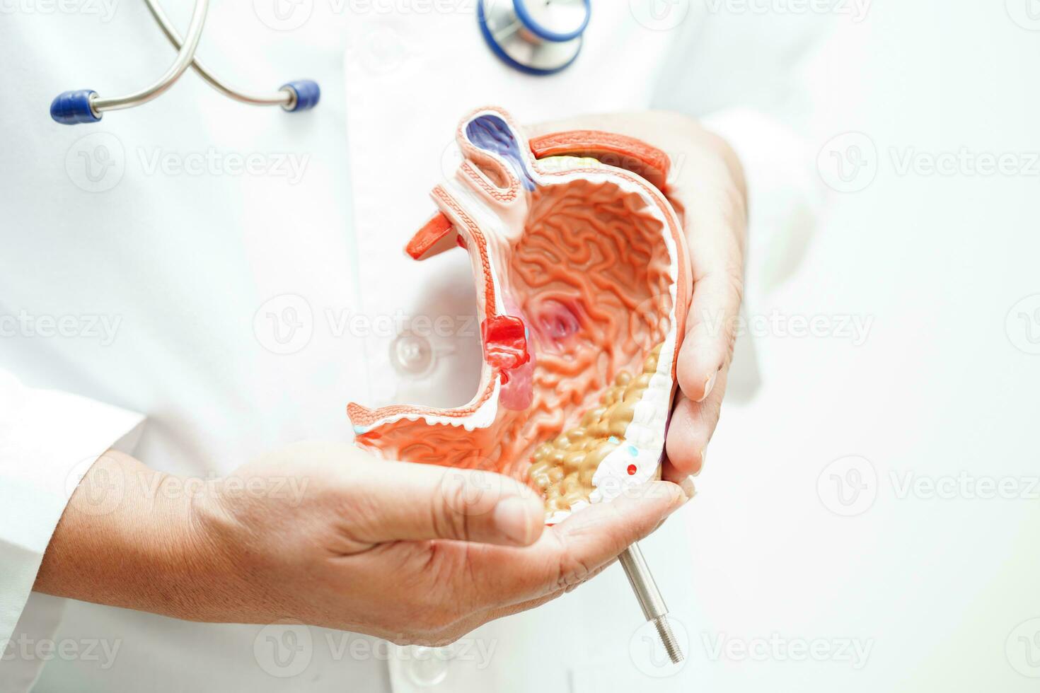 Stomach disease, doctor holding anatomy model for study diagnosis and treatment in hospital. photo