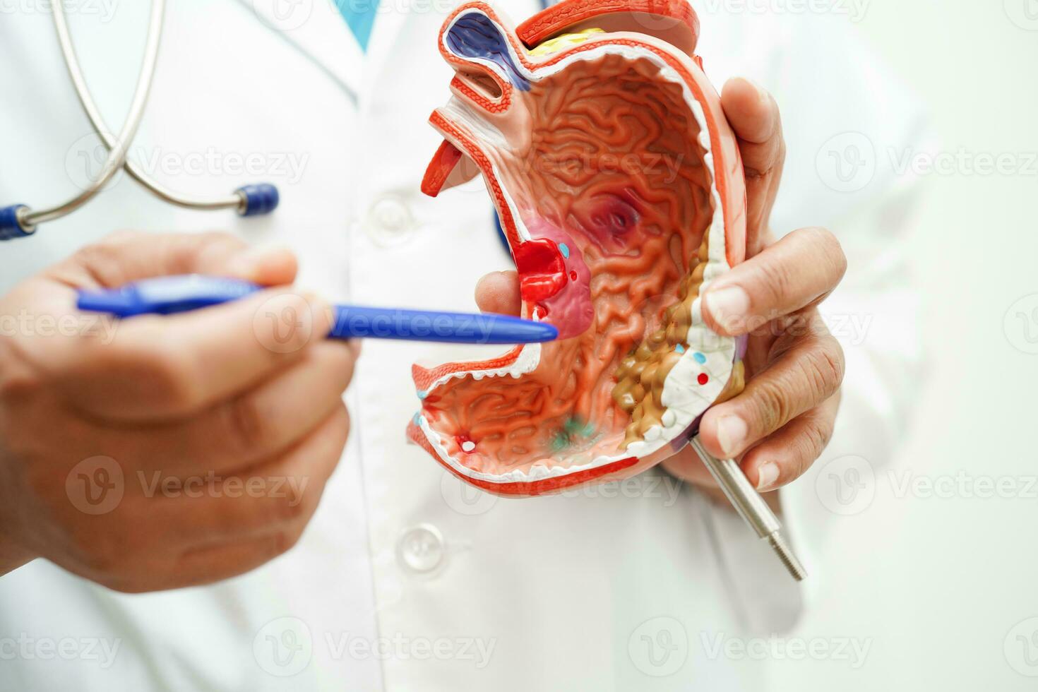 Stomach disease, doctor holding anatomy model for study diagnosis and treatment in hospital. photo