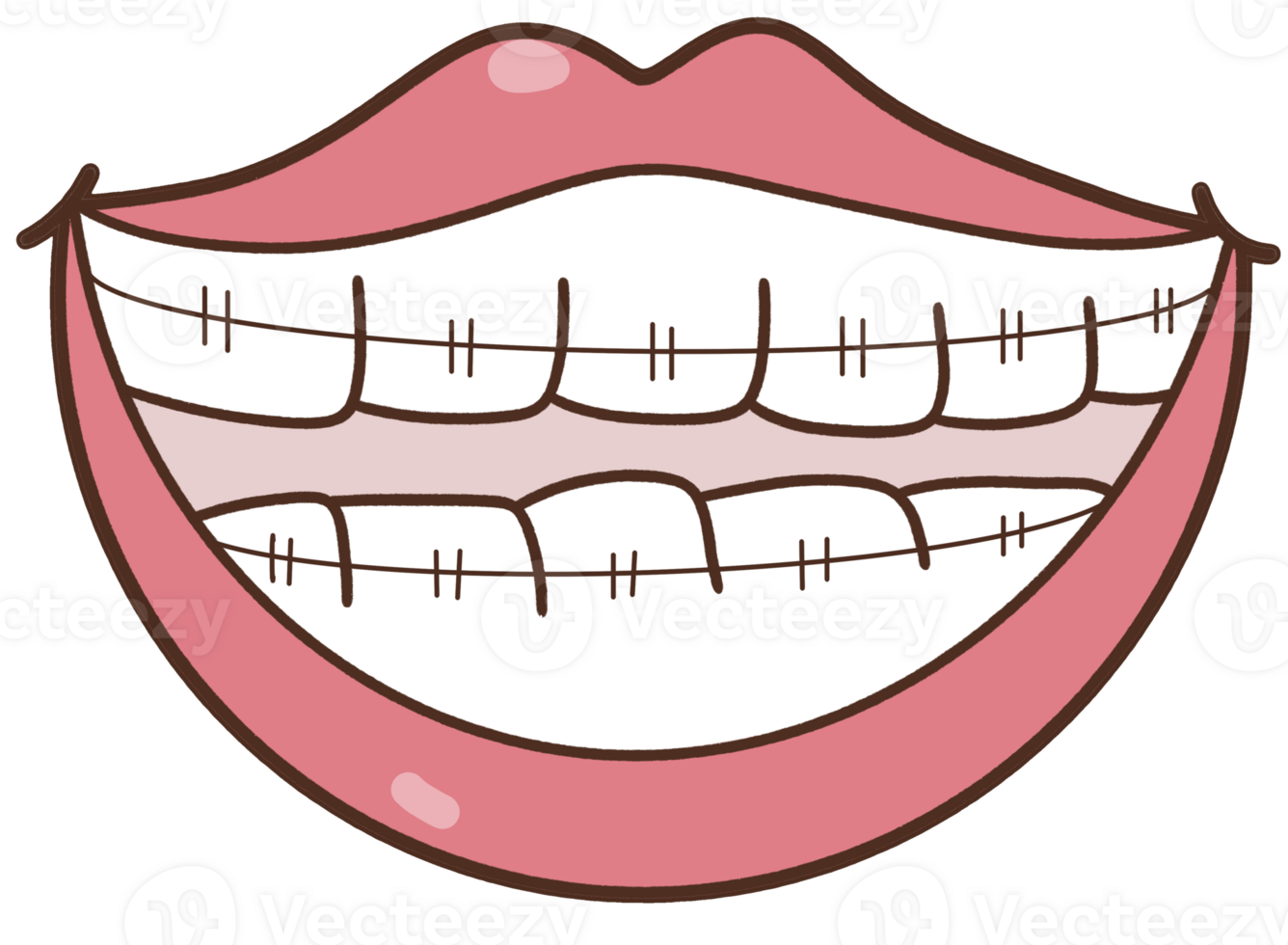 Dentist braces teeth png