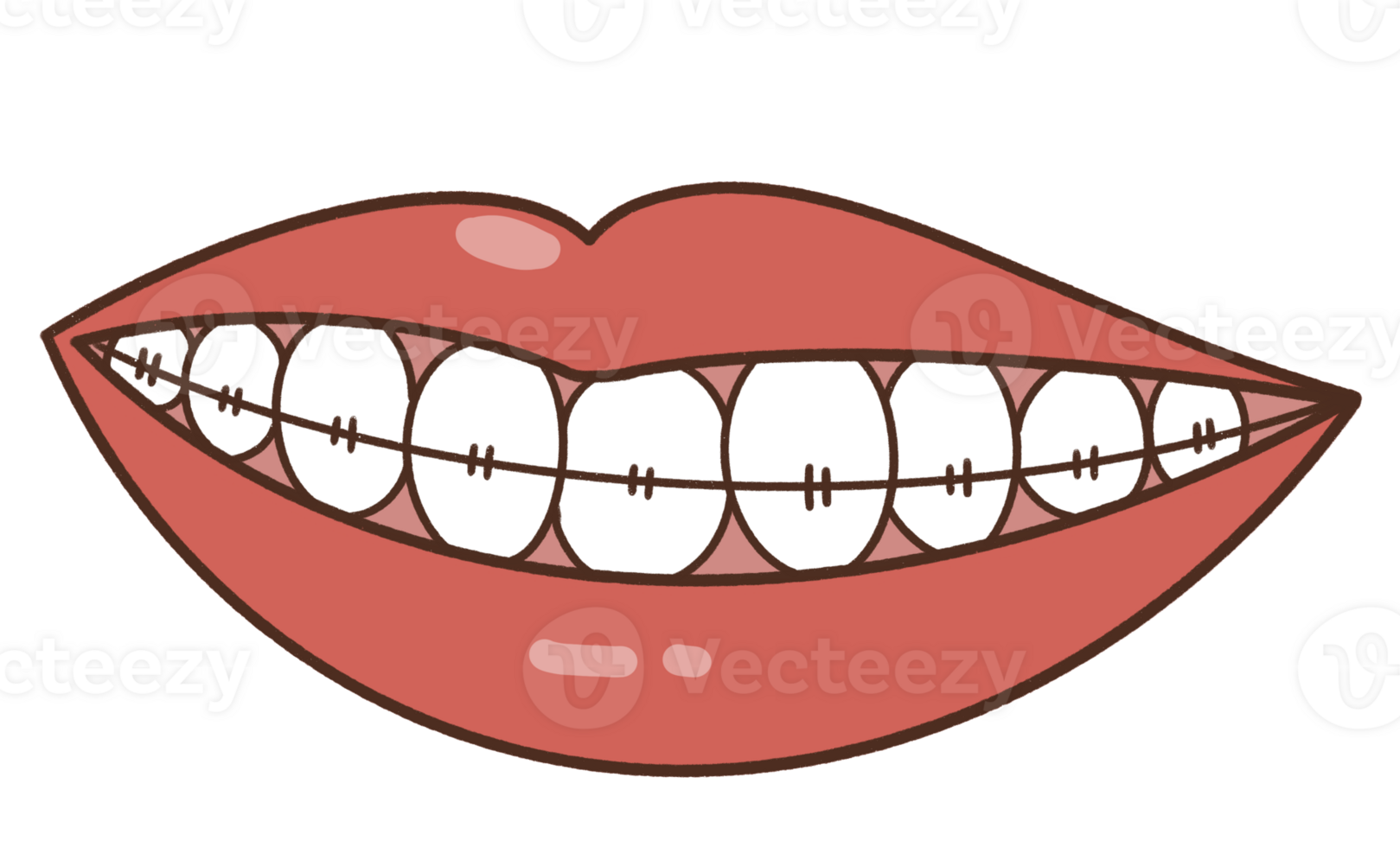 Dentist braces teeth png