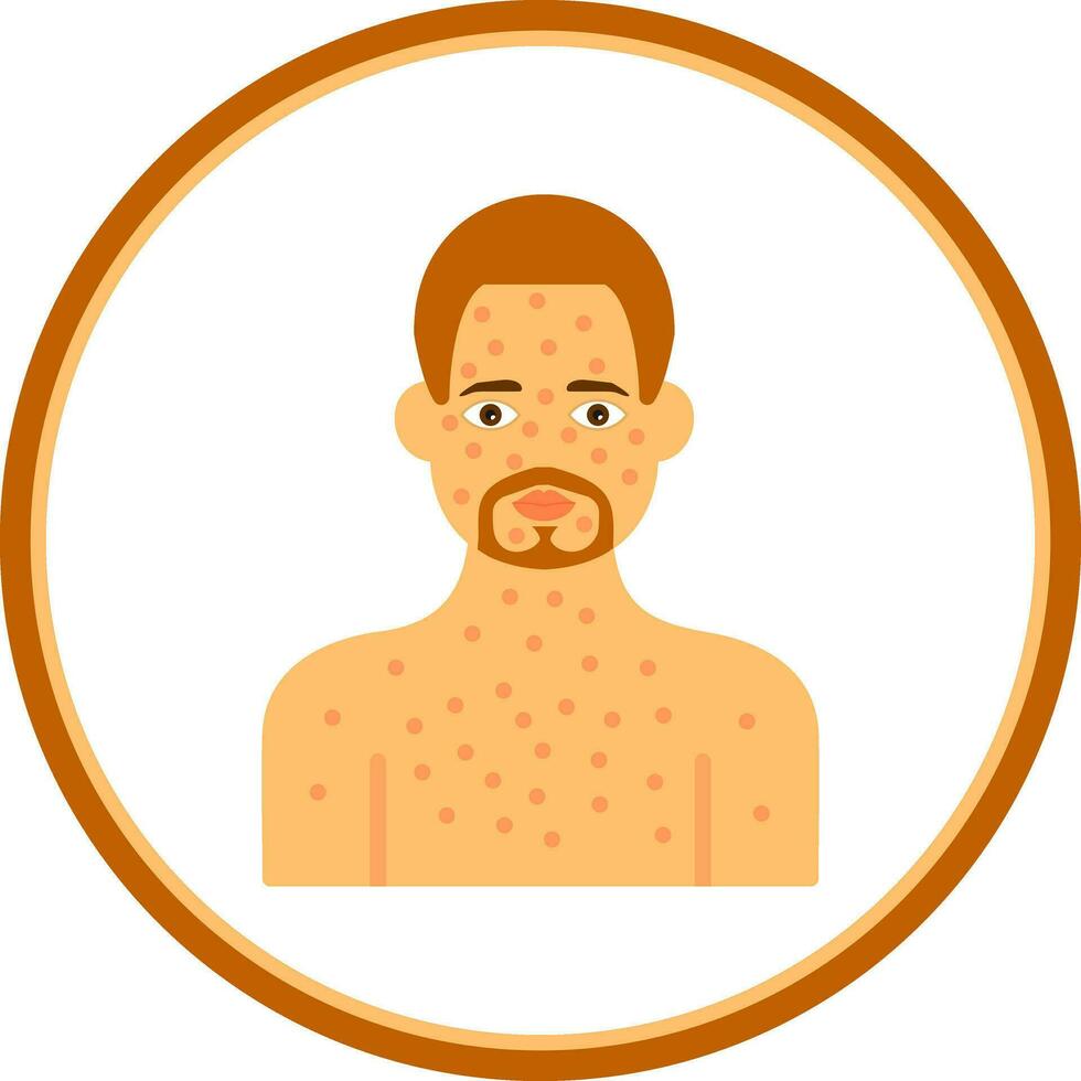 Anaphylaxis Vector Icon Design