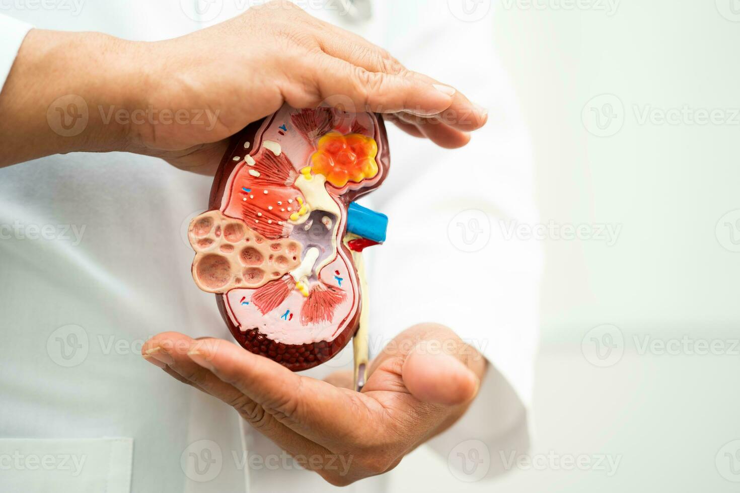 Kidney disease, Chronic kidney disease ckd, Doctor hold model to study and treat in hospital. photo