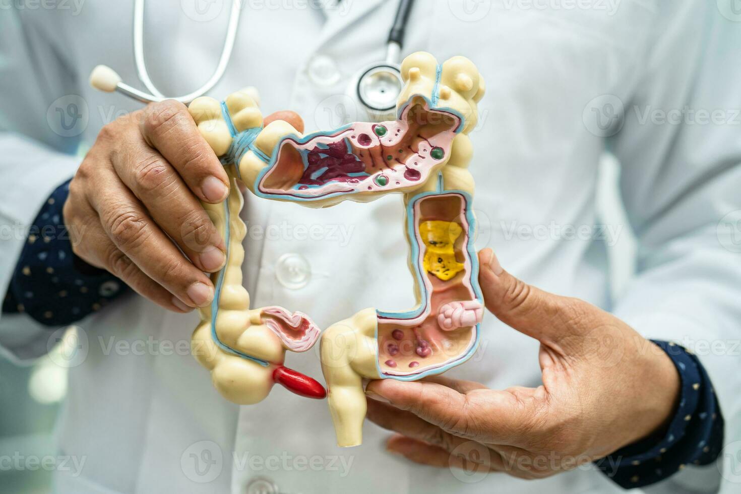 Intestine, appendix and digestive system, doctor holding anatomy model for study diagnosis and treatment in hospital. photo