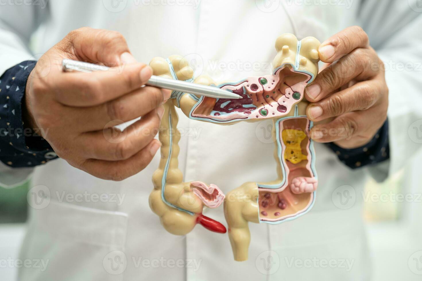 Intestine, appendix and digestive system, doctor holding anatomy model for study diagnosis and treatment in hospital. photo