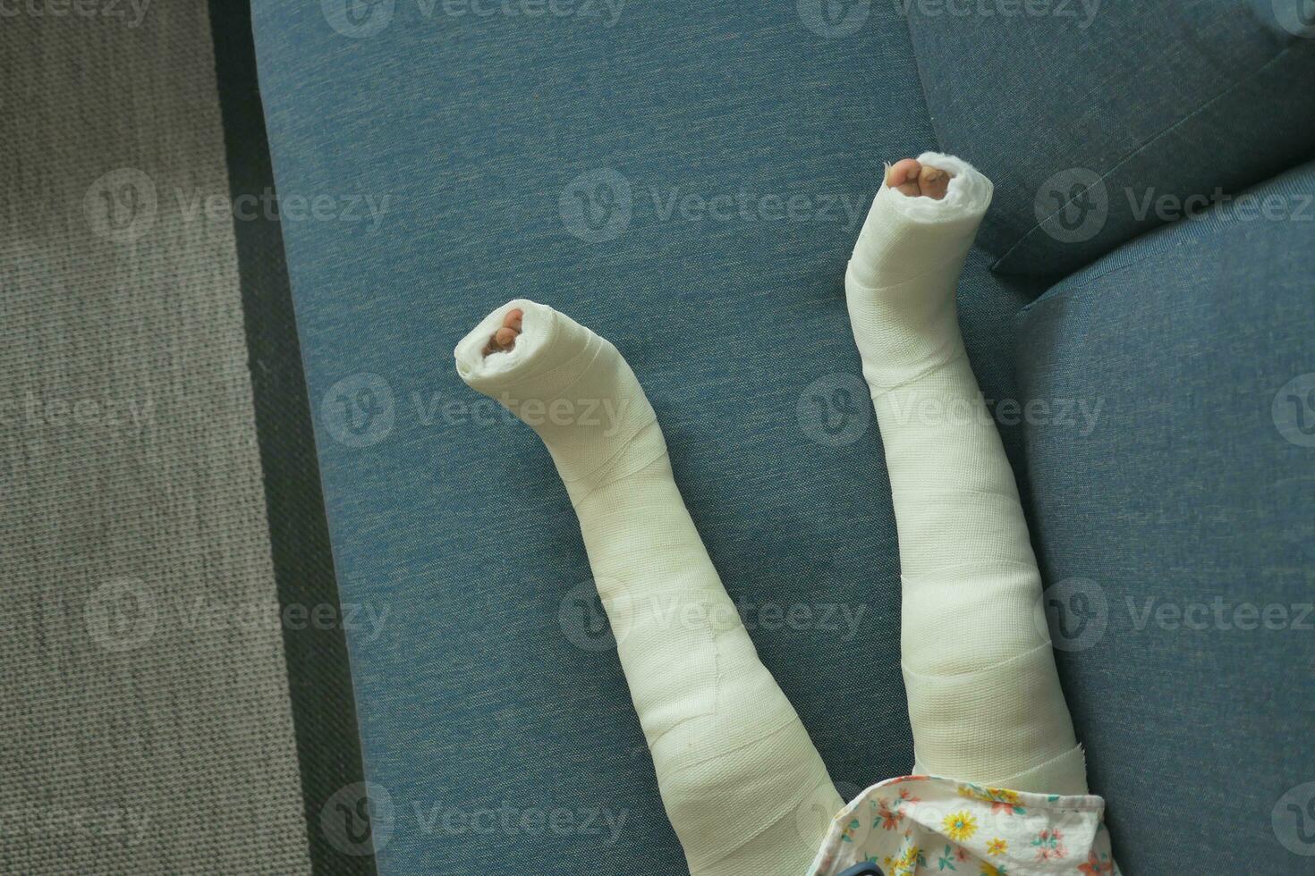 little child with plaster bandage on leg. photo