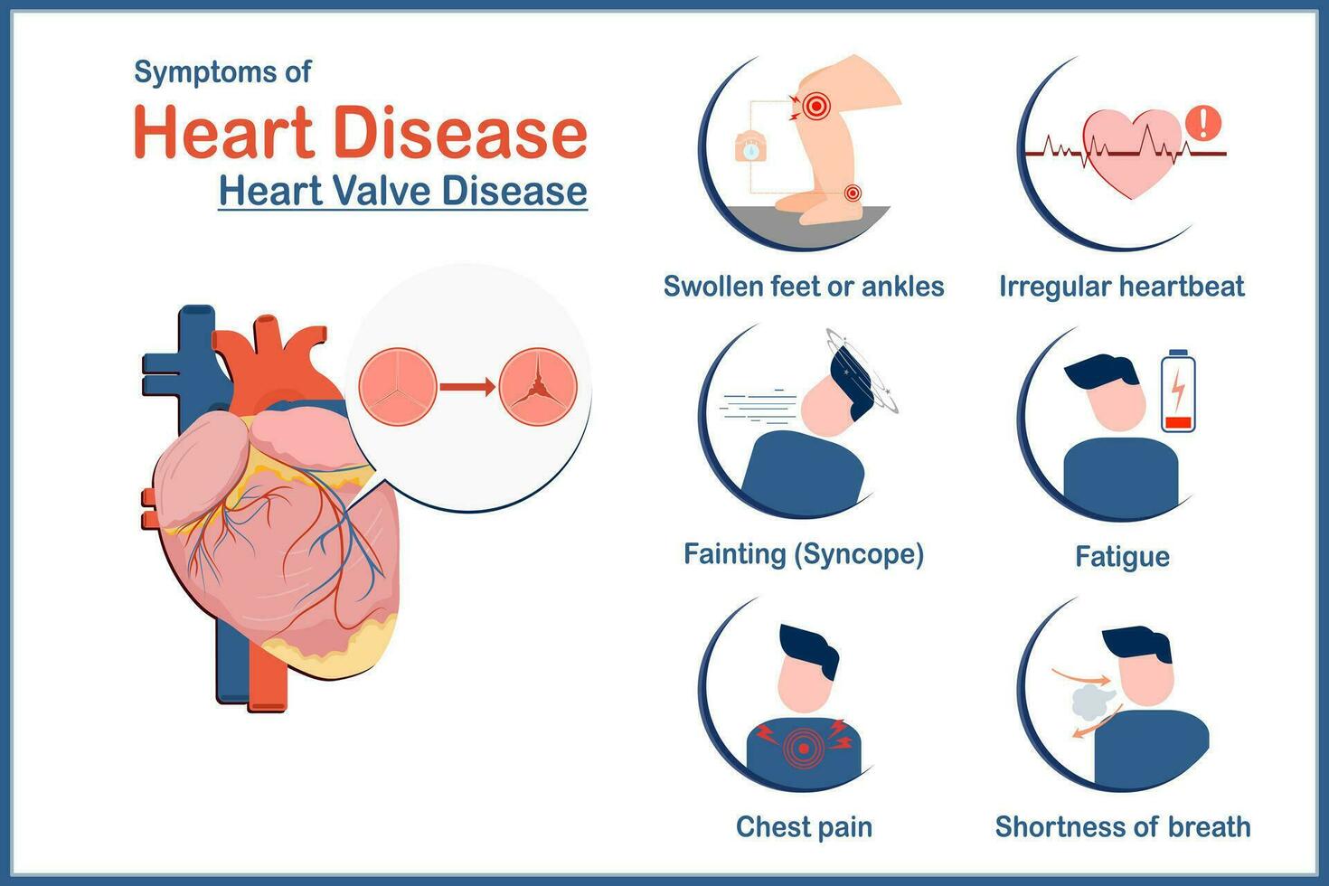 Medical illustration vector concept,symptoms of heart disease caused by heart valve disease.swollen feet or ankles,irregular heartbeat,fatigue,Shortness of breath,fainting or syncope flat style. 25249186 Vector Art at Vecteezy