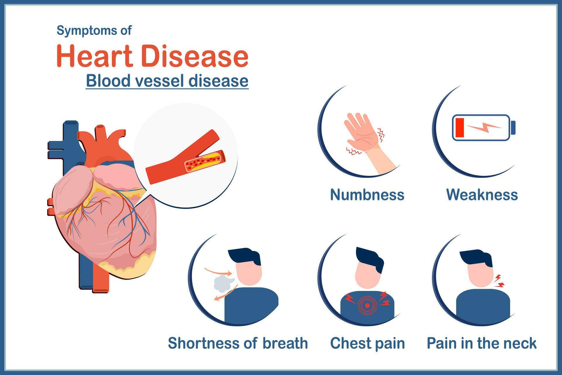 Medical illustration vector concept,symptoms of heart disease caused by