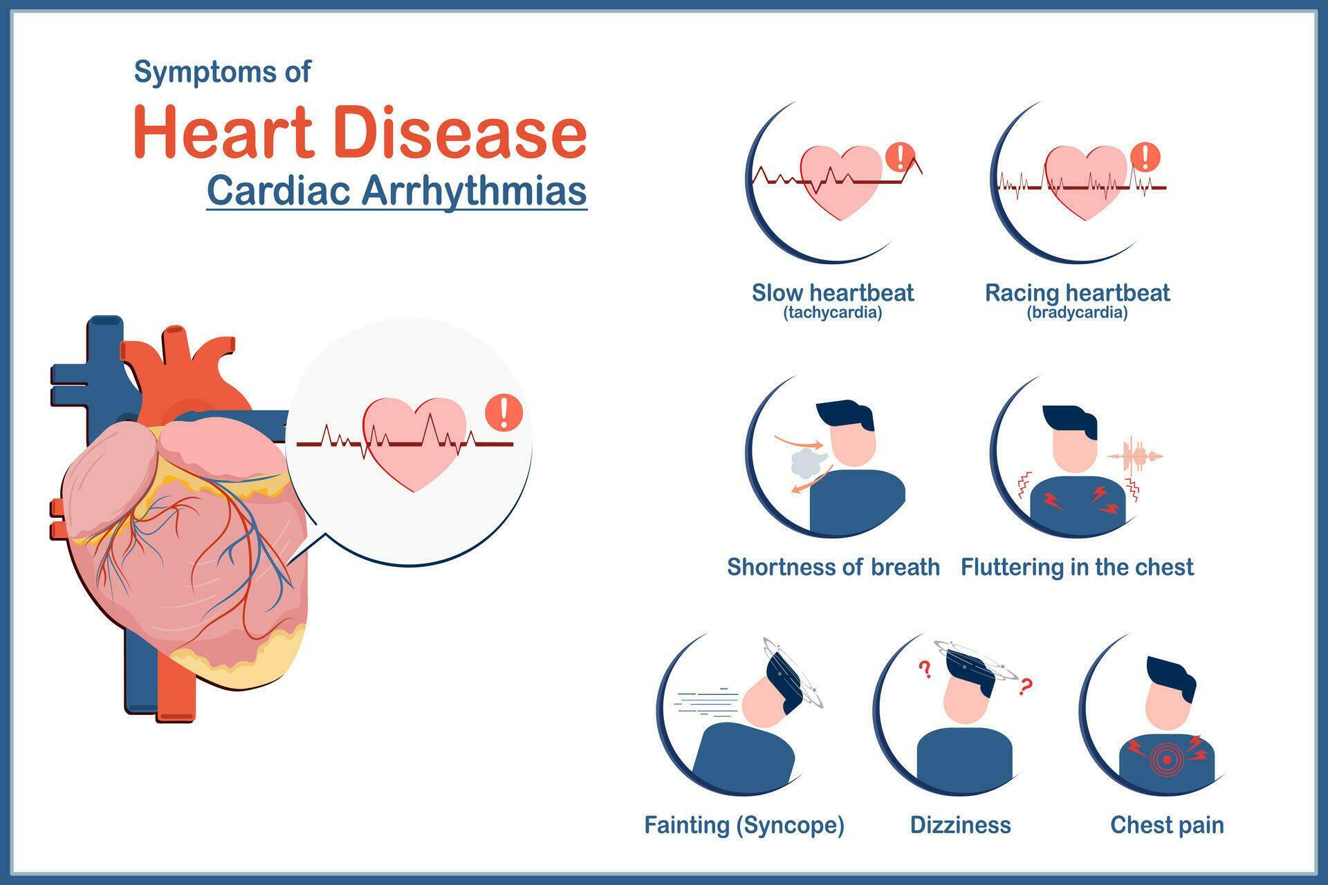 Medical illustration concept, heart disease symptoms caused by