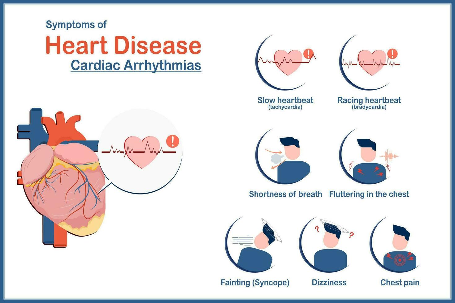 médico ilustración concepto, corazón enfermedad síntomas causado por irregular latido del corazón o cardíaco arritmias, fatiga, taquicardia, bradicardia, mareo, cofre dolor y síncope, plano estilo vector