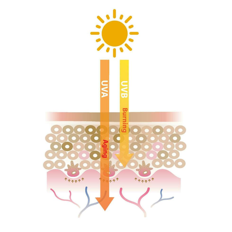 Infographic of UVA and UVB radiation penetrate into the skin layer vector on white background. UVA rays cause aging skin, UVB rays cause burning skin. Skin care and beauty concept illustration.