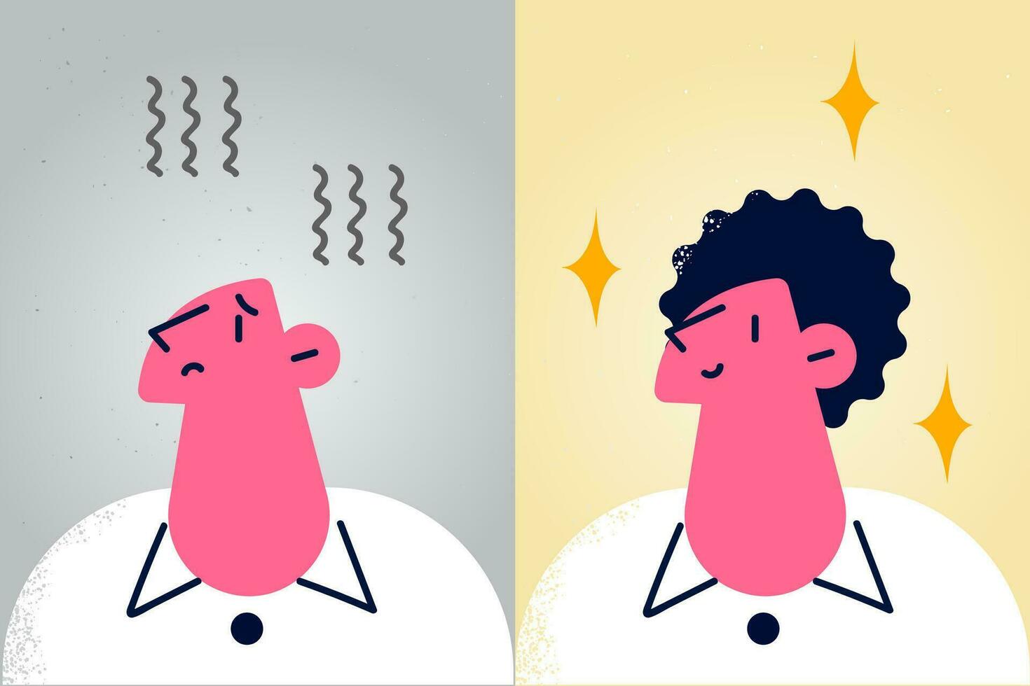 Unhappy bald and happy hairy man after hair transplantation procedure. Upset stressed guy suffer from alopecia get medical treatment. Before and after transplant result. Vector illustration.