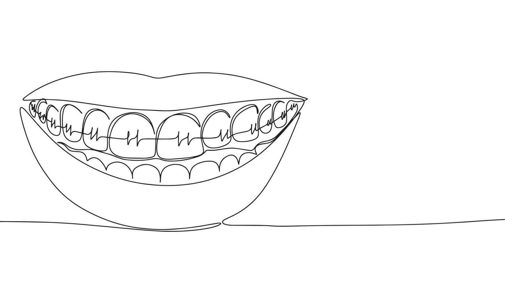 continuo línea dibujo de tirantes para dientes. vector ilustración como línea Arte contorno fondo de pantalla para mínimo póster, plantilla, bandera