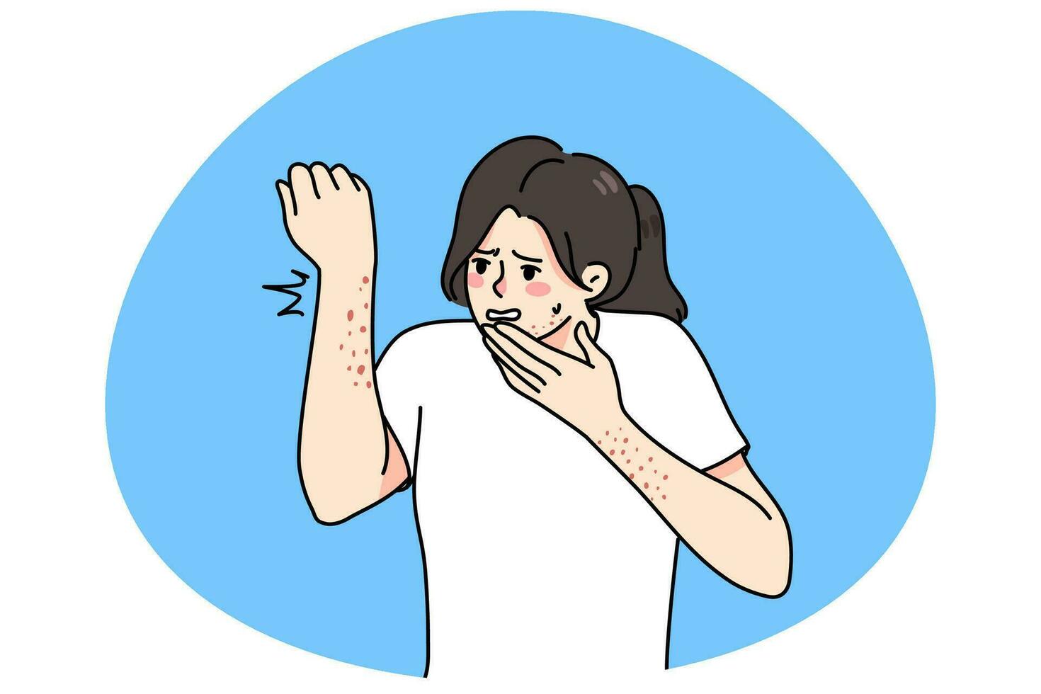 Woman frustrated with rash and dermatitis on body vector