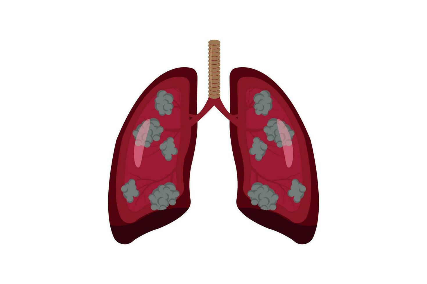 illustration of lung cancer. isolated on white background. eps 10 vector