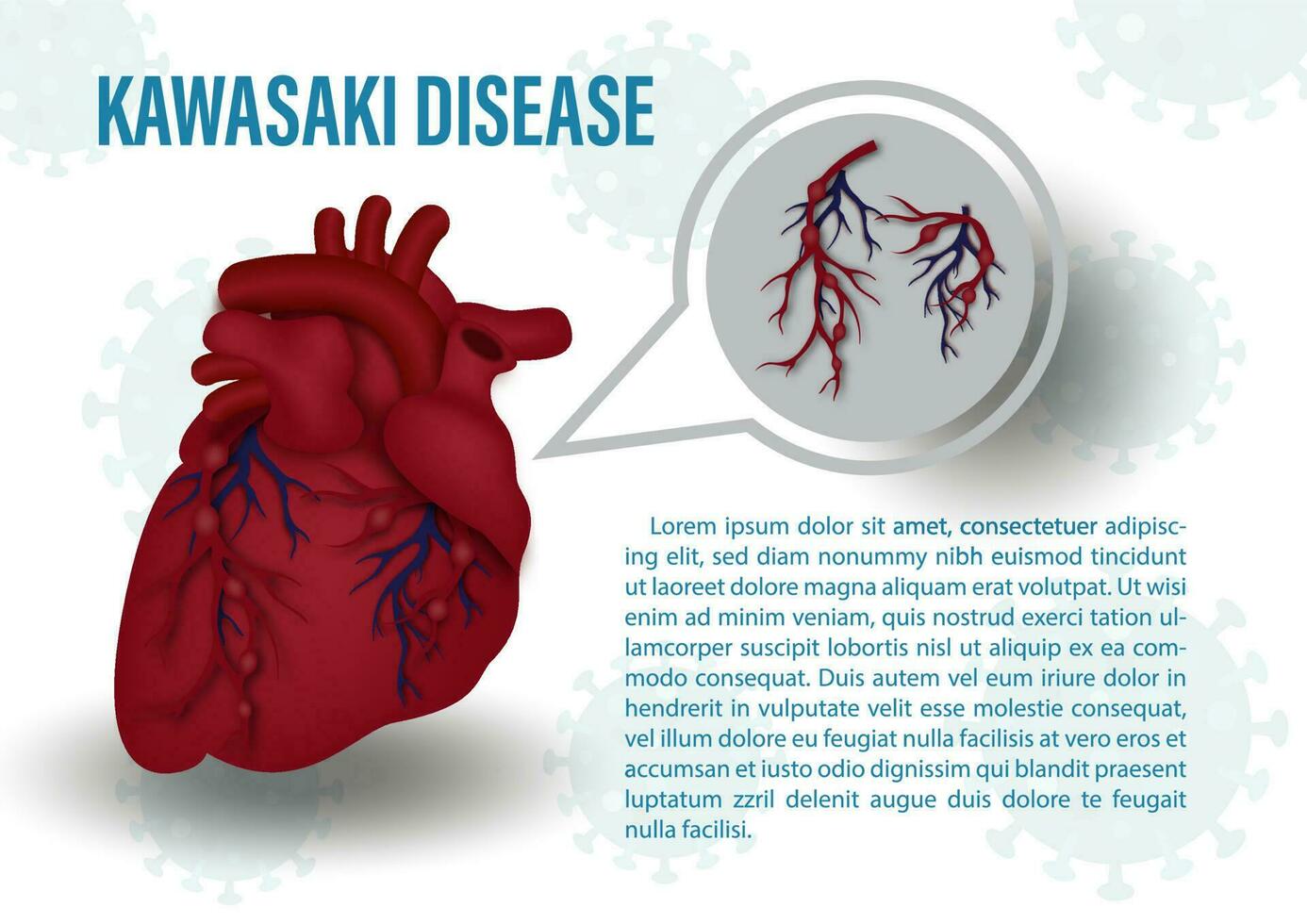 de cerca humano corazón con el kawasaki síntomas a rojo sangre vasos, el nombre y ejemplo textos en virus símbolos y blanco antecedentes. médicos póster de el kawasaki enfermedad en vector diseño.