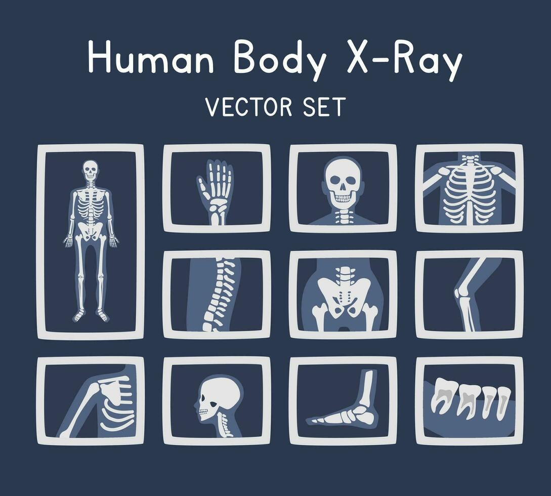 X Ray clipart cartoon style. Human body bones x ray flat vector set illustration hand drawn style. X Ray image of different body parts. Skeleton, hand, skull, spine, rib, pelvis, foot, teeth x ray set