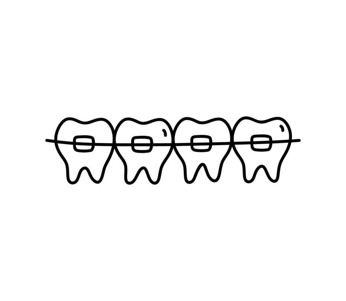 Braces on teeth isolated on white background. Orthodontic treatment. Vector hand-drawn illustration in doodle style. Perfect for logo, various designs.