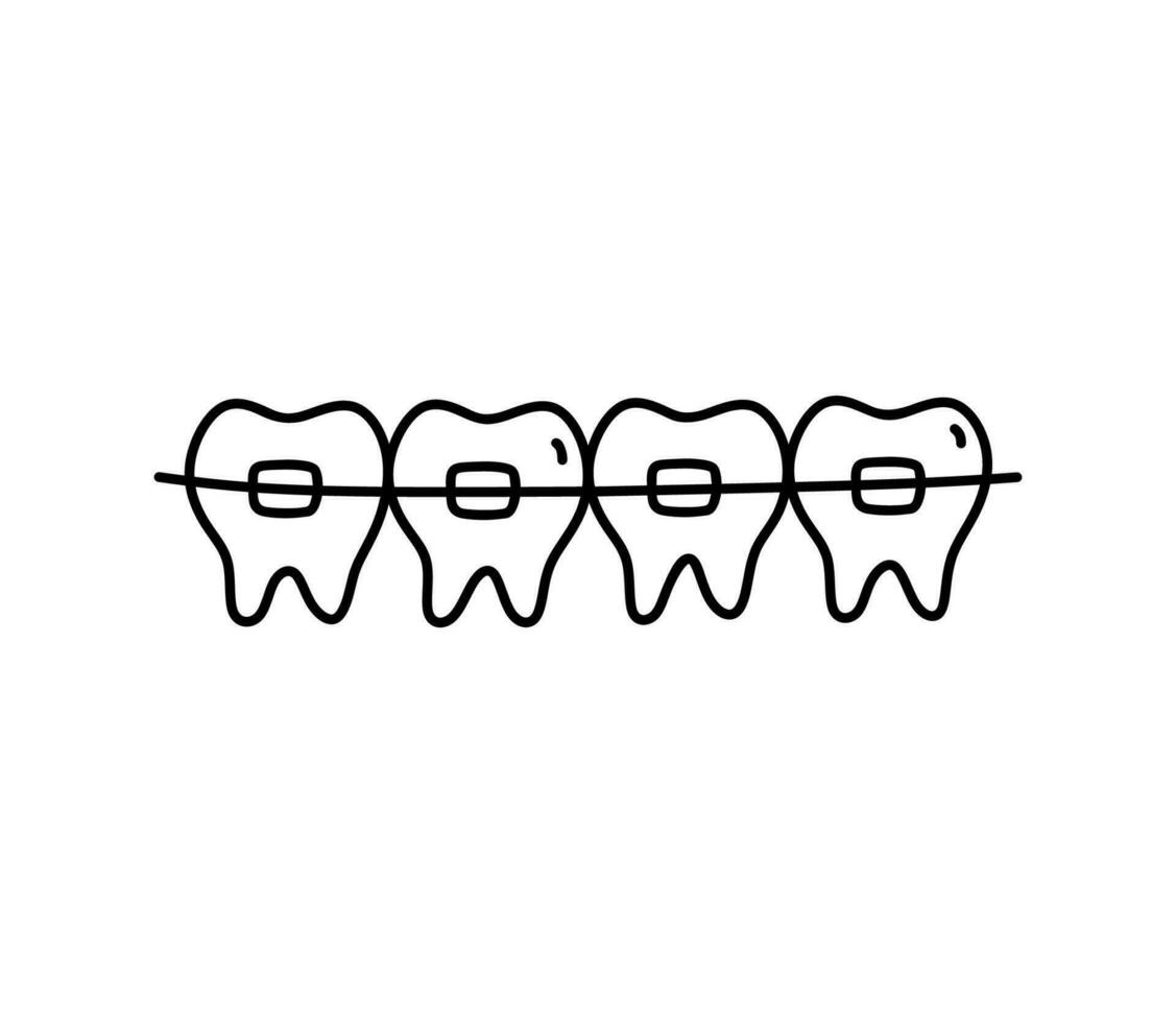 tirantes en dientes aislado en blanco antecedentes. ortodoncia tratamiento. vector dibujado a mano ilustración en garabatear estilo. Perfecto para logo, varios diseños