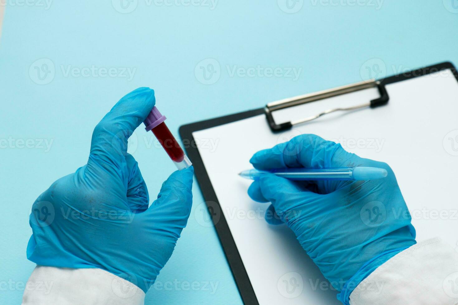 médico participación un prueba tubo con sangre y haciendo un Nota en papel foto