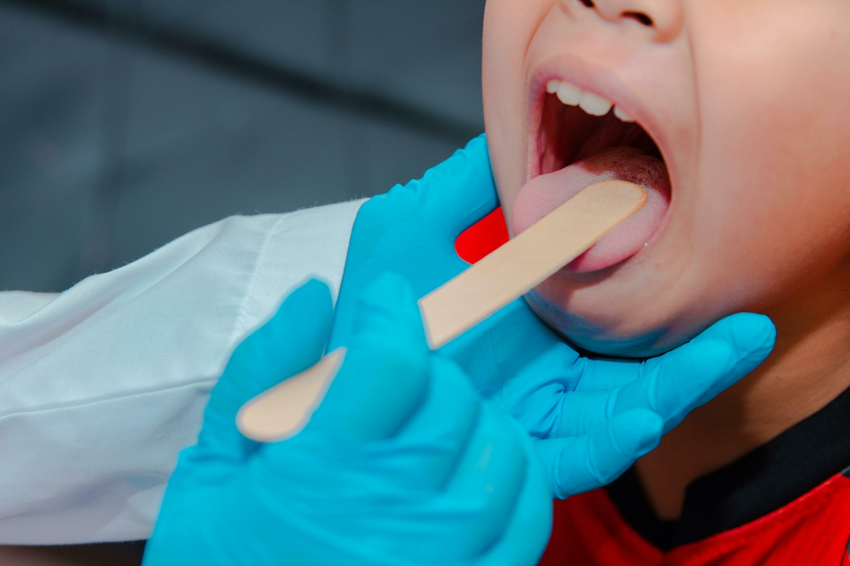 The doctor uses a tongue depressor to examine the child's tongue