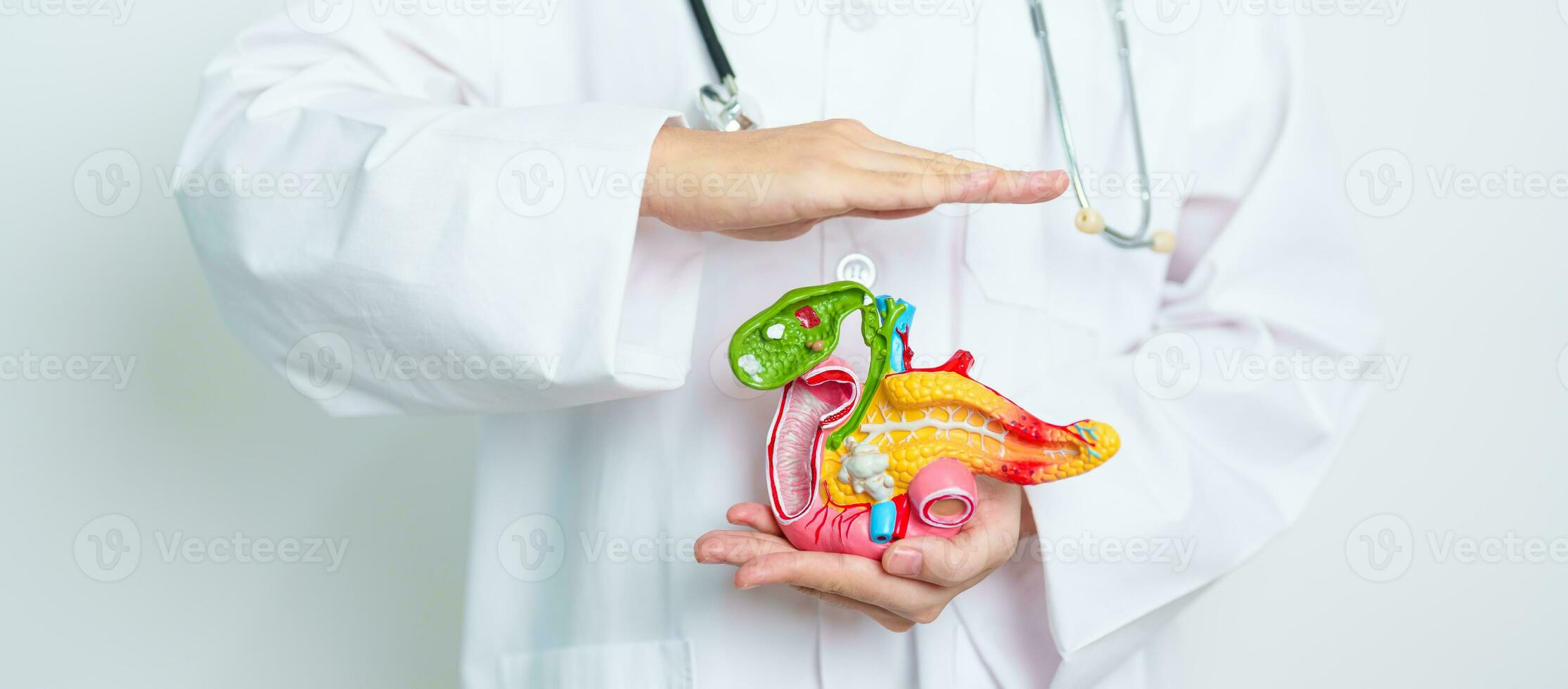 médico con humano pancreatitis anatomía modelo con páncreas, vesícula biliar, bilis conducto, duodeno, pequeño intestino. pancreático cáncer, agudo y crónico pancreatitis, digestivo sistema y salud concepto foto