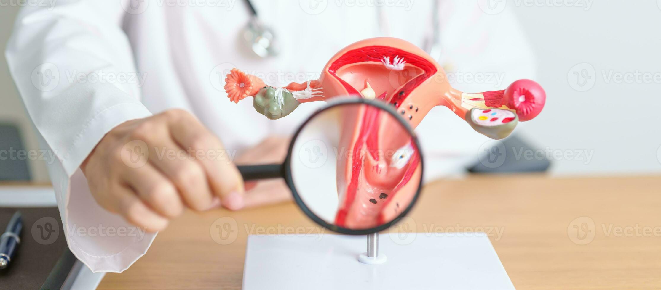 Doctor with Uterus and Ovaries anatomy model and magnifying glass. Ovarian and Cervical cancer, Cervix disorder, Endometriosis, Hysterectomy, Uterine fibroids, Reproductive system, Pregnancy photo